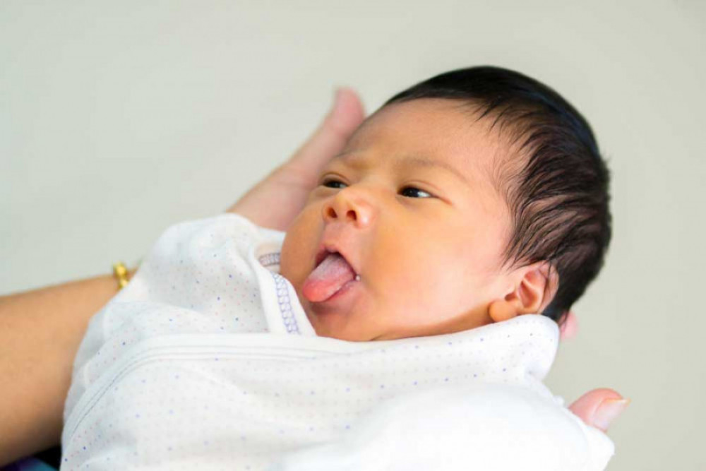 Bikin Rewel, Yuk Kenali Cara Mengobati Lidah Bayi yang Putih | Prenagen
