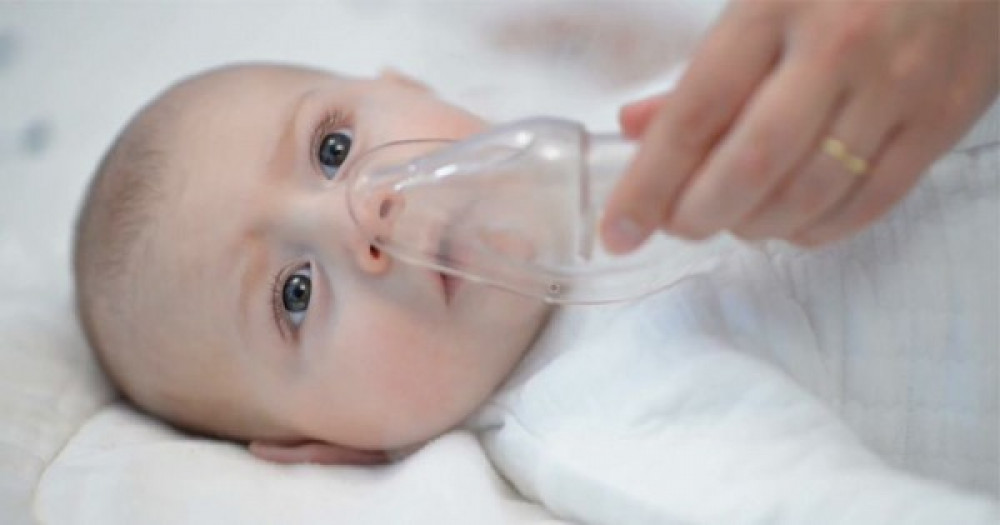 Cara Melakukan Terapi Uap untuk Bayi di Rumah