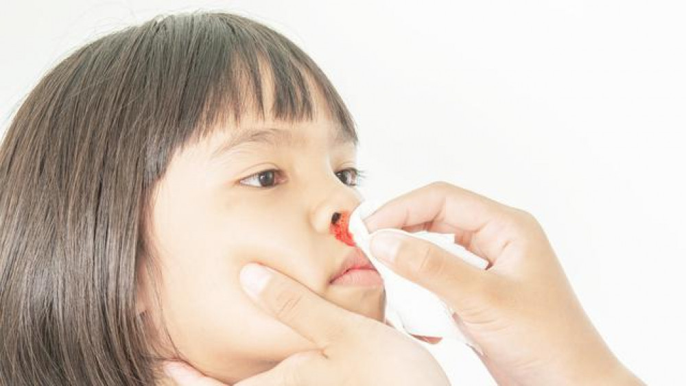 Cara Mengatasi Mimisan pada Anak dan Penyebabnya