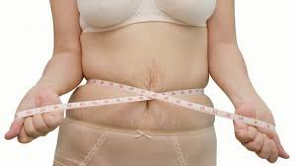 Cara Mengencangkan Perut Kendur Setelah Melahirkan