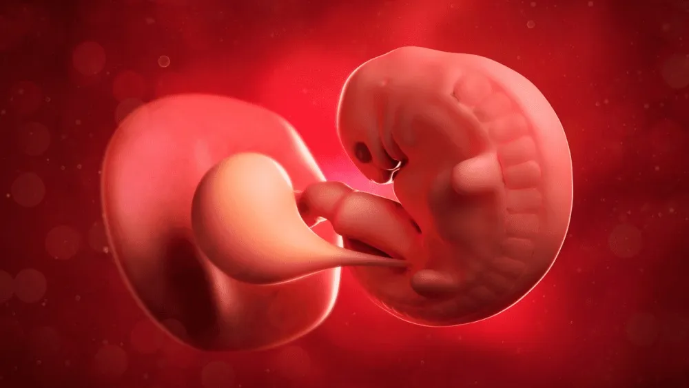 Intrauterine Growth Restriction