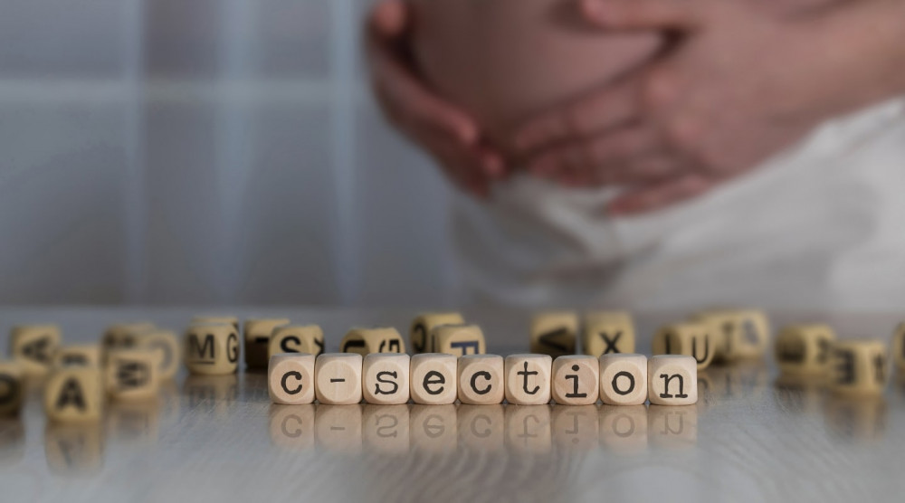 Ketahui Perkiraan Biaya Operasi Caesar Sebelum Melahirkan