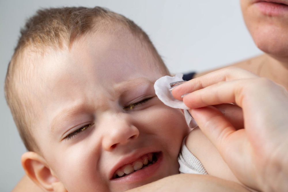 Benarkah ASI Bisa Mengobati Mata Belekan pada Bayi?