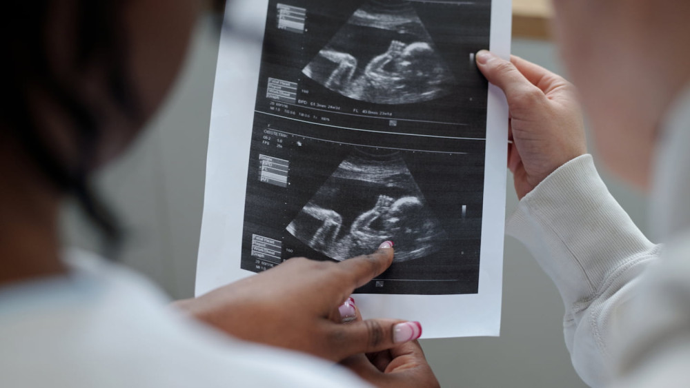 Tes Genetik untuk Kehamilan Geriatri & Kapan Waktu Terbaik Melakukannya