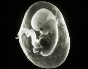 Getting To Know The Function Of Amniotic Fluids Prenagen